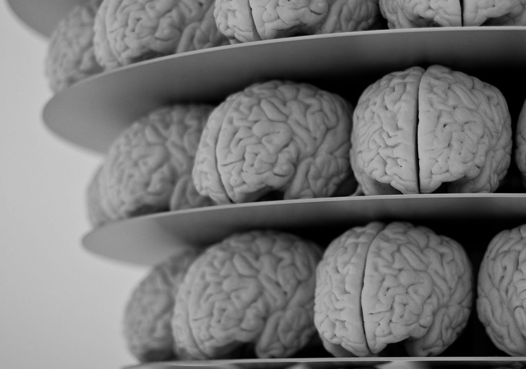 Plastic models of the human brain sit on shelves